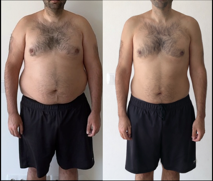 Rick, before and after